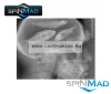 Spinmad Impulse Pro 5cm 6,5g Sinking wobbler (2803)